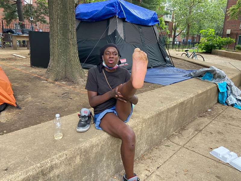 Tiara's feet are heavily blistered and injured.